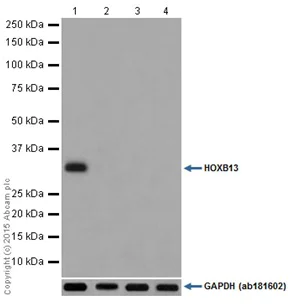Western blot - Anti-HOXB13 antibody [EPR17371] (AB201682)
