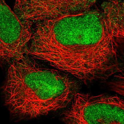 Immunocytochemistry/ Immunofluorescence - Anti-HOXB2 antibody (AB220390), expandable thumbnail