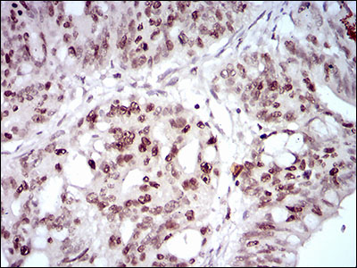 Immunohistochemistry (Formalin/PFA-fixed paraffin-embedded sections) - Anti-HOXB4 antibody [3A2F2] (AB201957)