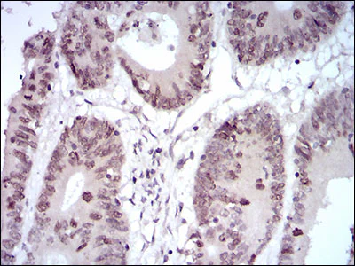 Immunohistochemistry (Formalin/PFA-fixed paraffin-embedded sections) - Anti-HOXB4 antibody [3A2F2] (AB201957)