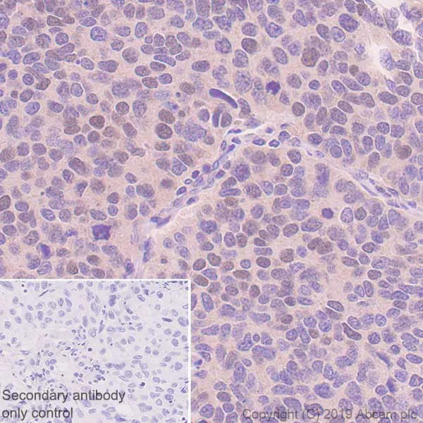 Immunohistochemistry (Formalin/PFA-fixed paraffin-embedded sections) - Anti-HOXB4 antibody [EP1919Y] (AB76093)
