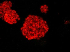 Immunocytochemistry/ Immunofluorescence - Anti-HOXB4 antibody [EPR1917] - BSA and Azide free (AB232019), expandable thumbnail