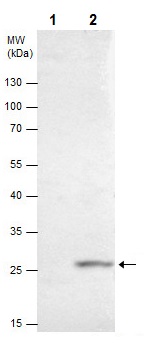 Immunoprecipitation - Anti-HOXB5 antibody (AB229345), expandable thumbnail