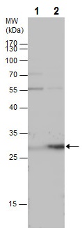 Western blot - Anti-HOXB5 antibody (AB229345), expandable thumbnail