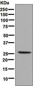 Western blot - Anti-HOXB9 antibody [EPR6950] - BSA and Azide free (AB248623), expandable thumbnail