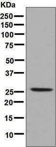 Western blot - Anti-HOXB9 antibody [EPR6950] - BSA and Azide free (AB248623)