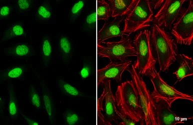 Immunocytochemistry/ Immunofluorescence - Anti-HOXC10 antibody (AB153904)