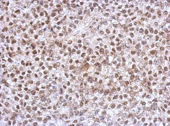 Immunohistochemistry (Formalin/PFA-fixed paraffin-embedded sections) - Anti-HOXC10 antibody (AB153904)