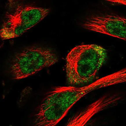 Immunocytochemistry/ Immunofluorescence - Anti-HOXC11 antibody (AB243721)