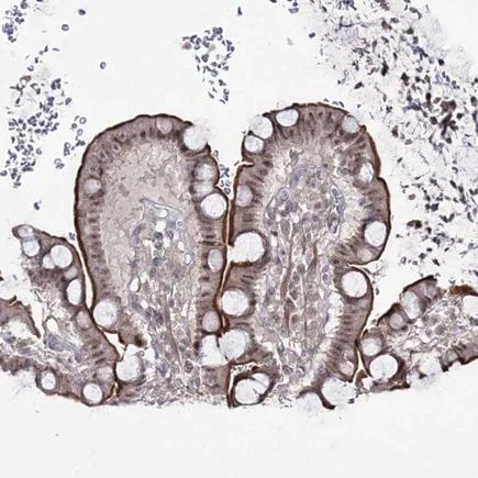 Immunohistochemistry (Formalin/PFA-fixed paraffin-embedded sections) - Anti-HOXC11 antibody (AB243721)