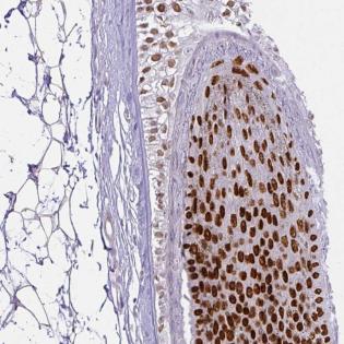 Immunohistochemistry (Formalin/PFA-fixed paraffin-embedded sections) - Anti-HOXC13 antibody (AB188043)