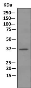 Immunoprecipitation - Anti-HOXC13 antibody [EPR5626] (AB168368)