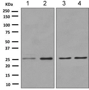 Western blot - Anti-HoxC6 antibody [EPR7922(2)] (AB151575)