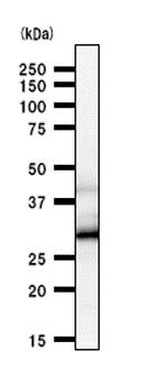 Western blot - Anti-HOXC9 antibody [HOXCA6E6] (AB50839), expandable thumbnail