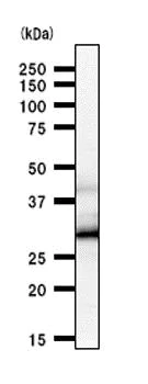 Western blot - Anti-HOXC9 antibody [HOXCA6E6] (AB50839)