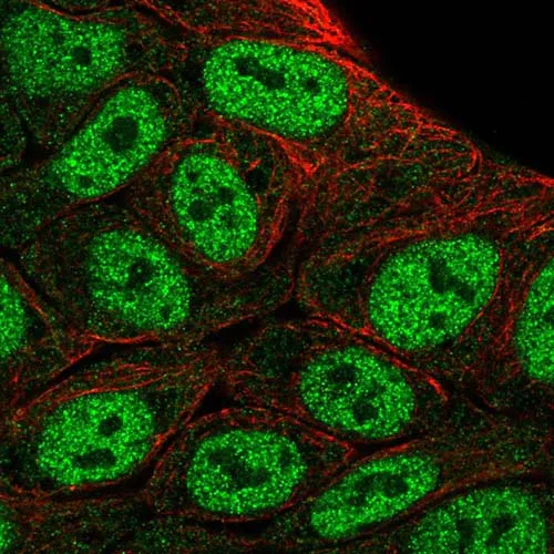 Immunocytochemistry/ Immunofluorescence - Anti-HOXD1 antibody (AB220856)