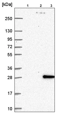 Western blot - Anti-HOXD1 antibody (AB220856)