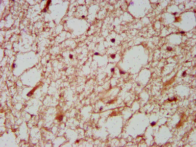 Immunohistochemistry (Formalin/PFA-fixed paraffin-embedded sections) - Anti-HOXD1 antibody (AB235103)