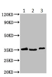 Western blot - Anti-HOXD1 antibody (AB235103)