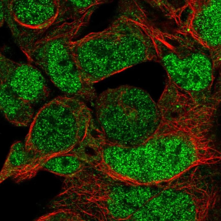 Immunocytochemistry/ Immunofluorescence - Anti-HOXD10 Antibody (AB327264)