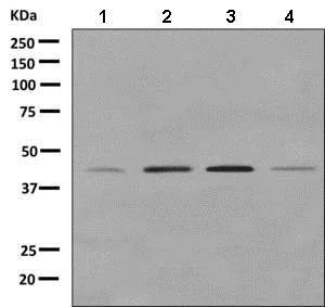 Western blot - Anti-HOXD10 antibody [EPR9374] - BSA and Azide free (AB248855)