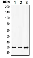 Western blot - Anti-HOXD12 antibody - C-terminal (AB230697)