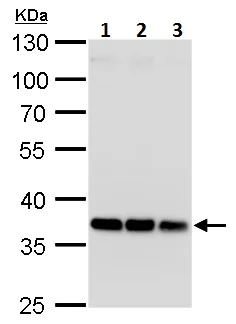 Western blot - Anti-HOXD13 antibody (AB229234)