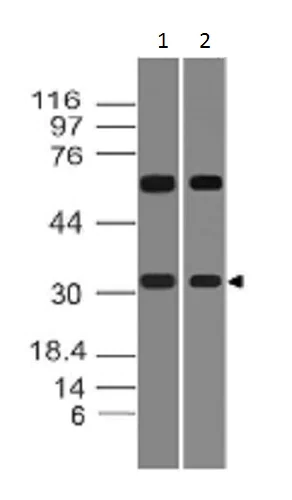 Western blot - Anti-HOXD8 antibody (AB228450)