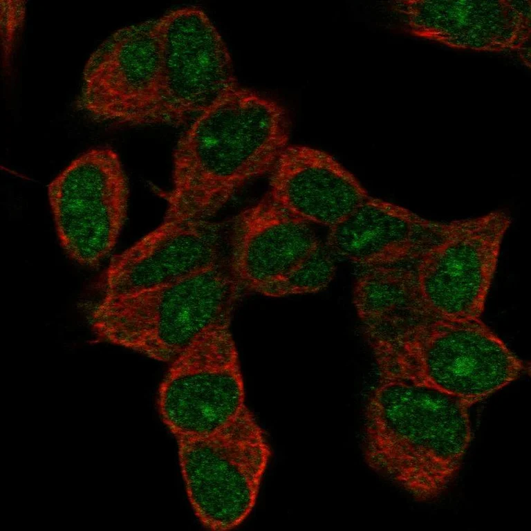 Immunocytochemistry/ Immunofluorescence - Anti-HOXD9 Antibody (AB327271)