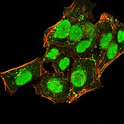Immunocytochemistry/ Immunofluorescence - Anti-HP1 alpha antibody [3A11F8] (AB234085), expandable thumbnail