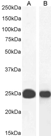 Western blot - Anti-HP1 alpha antibody (AB77256)
