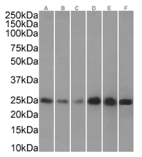 Western blot - Anti-HP1 alpha antibody [RAB-C133] (AB317725)
