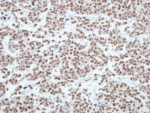 Immunohistochemistry (Formalin/PFA-fixed paraffin-embedded sections) - Anti-HP1 gamma/CBX3 antibody (AB227478)