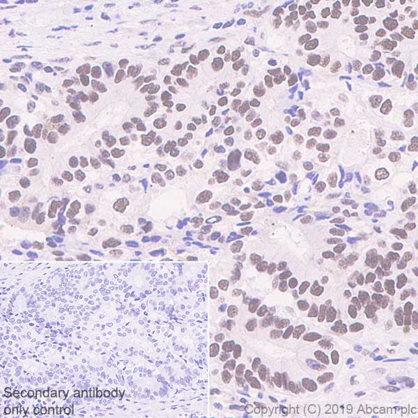 Immunohistochemistry (Formalin/PFA-fixed paraffin-embedded sections) - Anti-HP1 gamma/CBX3 antibody [EPR10465(B)] (AB154871), expandable thumbnail