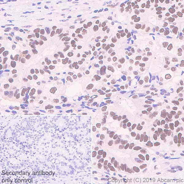 Immunohistochemistry (Formalin/PFA-fixed paraffin-embedded sections) - Anti-HP1 gamma/CBX3 antibody [EPR10465(B)] (AB154871)