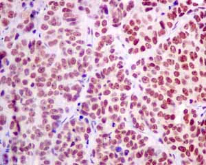 Immunohistochemistry (Formalin/PFA-fixed paraffin-embedded sections) - Anti-HP1 gamma/CBX3 antibody [EPR10465(B)] (AB154871)