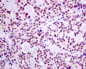 Immunohistochemistry (Formalin/PFA-fixed paraffin-embedded sections) - Anti-HP1 gamma/CBX3 antibody [EPR10465(B)] (AB154871)