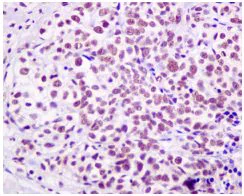 Immunohistochemistry (Formalin/PFA-fixed paraffin-embedded sections) - Anti-HP1 gamma/CBX3 antibody [EPR10465(B)] (AB154871)
