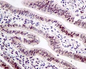 Immunohistochemistry (Formalin/PFA-fixed paraffin-embedded sections) - Anti-HP1 gamma/CBX3 antibody [EPR10465(B)] - BSA and Azide free (ab249170), expandable thumbnail