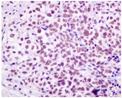 Immunohistochemistry (Formalin/PFA-fixed paraffin-embedded sections) - Anti-HP1 gamma/CBX3 antibody [EPR10465(B)] - BSA and Azide free (AB249170), expandable thumbnail