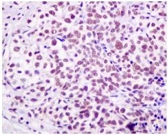 Immunohistochemistry (Formalin/PFA-fixed paraffin-embedded sections) - Anti-HP1 gamma/CBX3 antibody [EPR10465(B)] - BSA and Azide free (AB249170)
