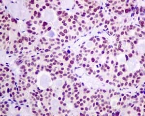 Immunohistochemistry (Formalin/PFA-fixed paraffin-embedded sections) - Anti-HP1 gamma/CBX3 antibody [EPR10465(B)] - BSA and Azide free (ab249170), expandable thumbnail