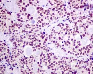 Immunohistochemistry (Formalin/PFA-fixed paraffin-embedded sections) - Anti-HP1 gamma/CBX3 antibody [EPR10465(B)] - BSA and Azide free (AB249170)