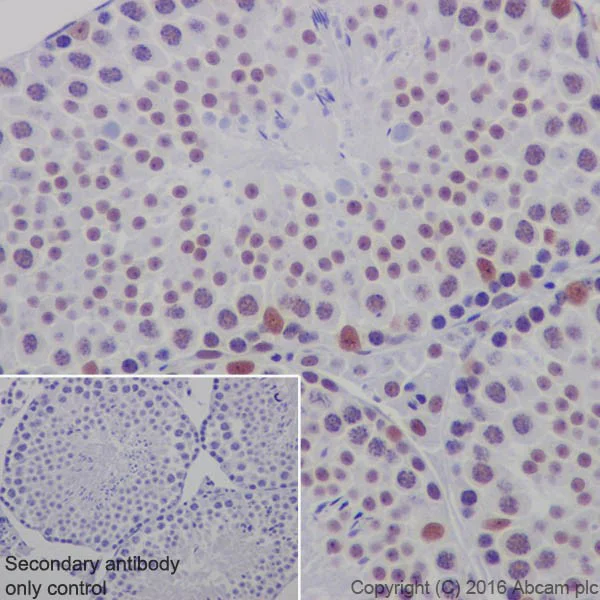 Immunohistochemistry (Formalin/PFA-fixed paraffin-embedded sections) - Anti-HP1 gamma/CBX3 antibody [EPR19803] - BSA and Azide free (AB251540)