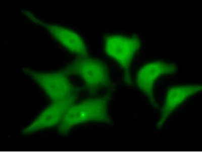 Immunocytochemistry/ Immunofluorescence - Anti-HPD antibody (AB232906)