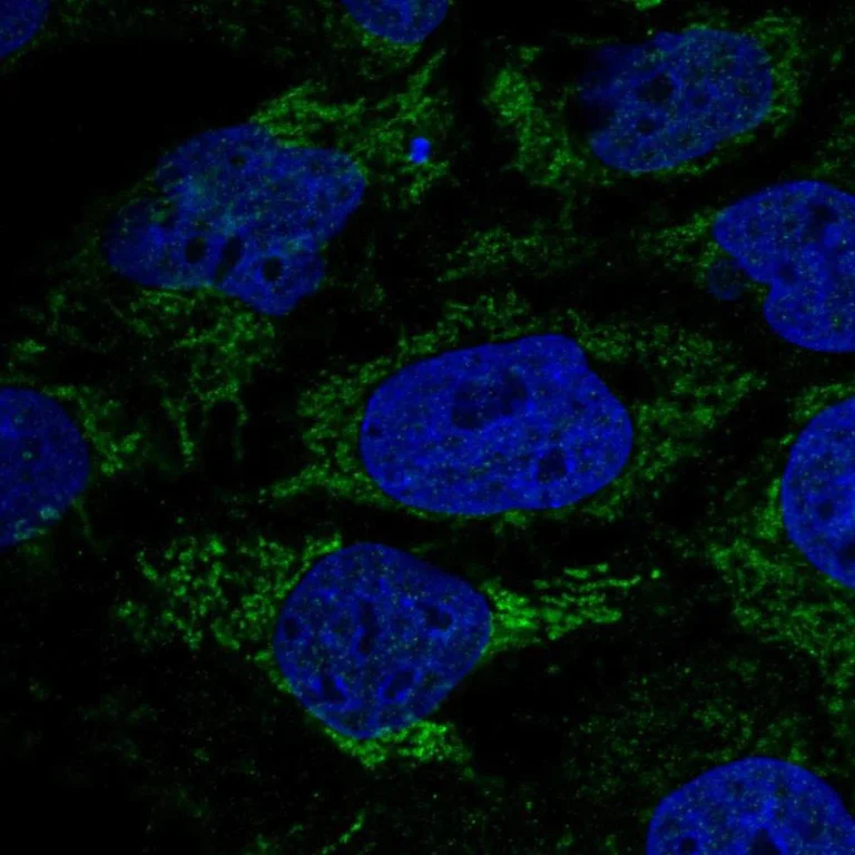Immunocytochemistry/ Immunofluorescence - Anti-HPDL antibody (AB246986)