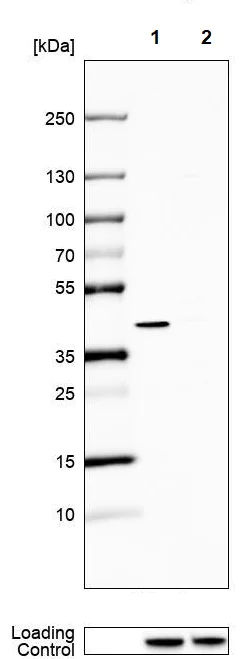Western blot - Anti-HPDL antibody (AB246986)