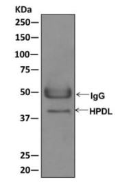 Immunoprecipitation - Anti-HPDL antibody [EPR11691] - BSA and Azide free (AB249829), expandable thumbnail