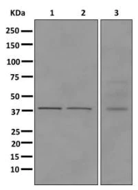 Western blot - Anti-HPDL antibody [EPR11691] - BSA and Azide free (AB249829)