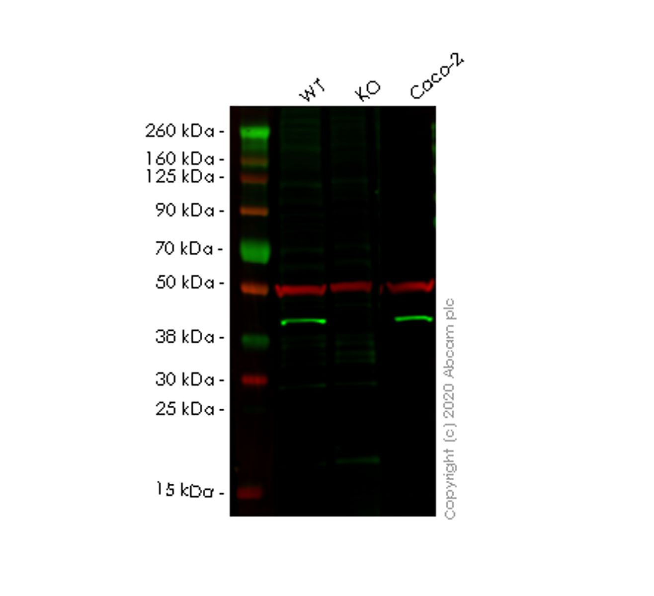 Western blot - Anti-HPDL antibody [EPR11691] - C-terminal (AB174841)